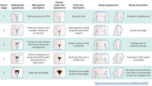 The Stages of Puberty for Girls