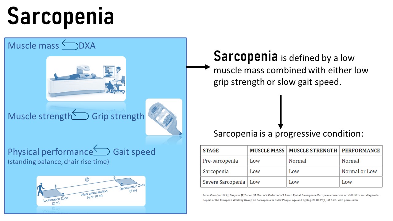 Obesity, Sarcopenia, And Frailty Prevent Longevity – Nutrition Through ...