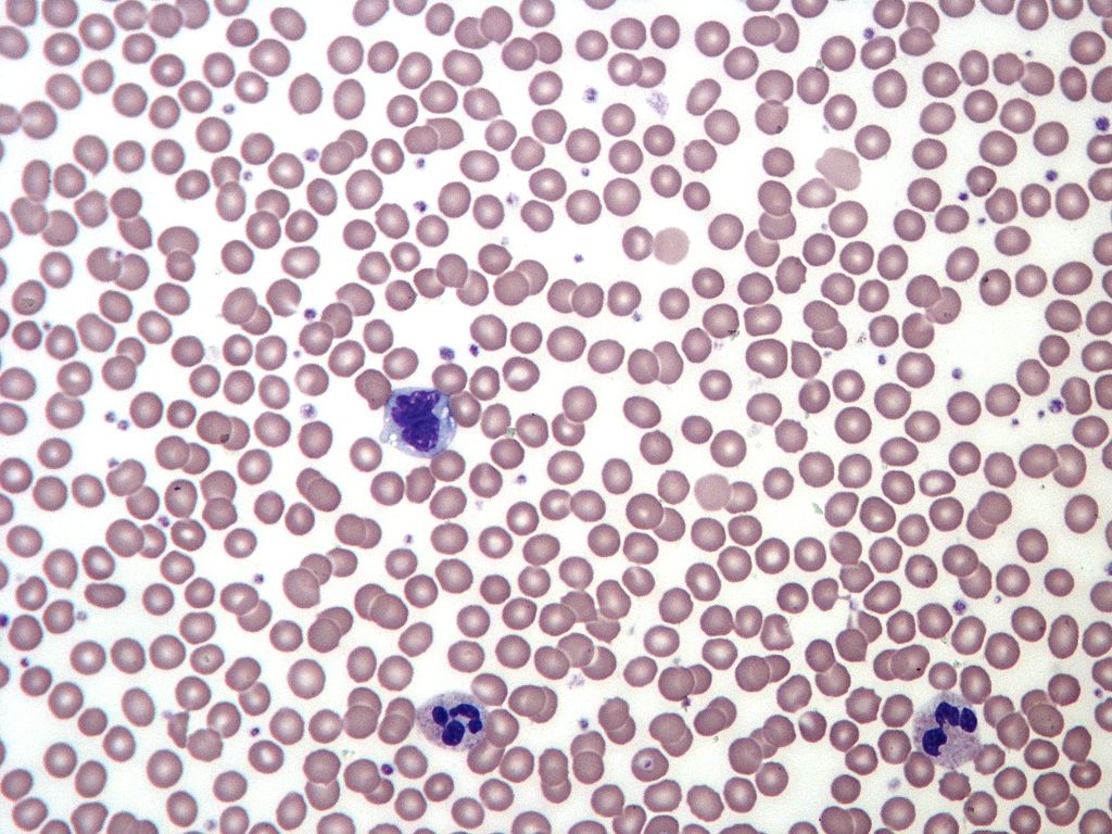 normal blood smear shows a couple of neutrophils and a monocyte with red cells