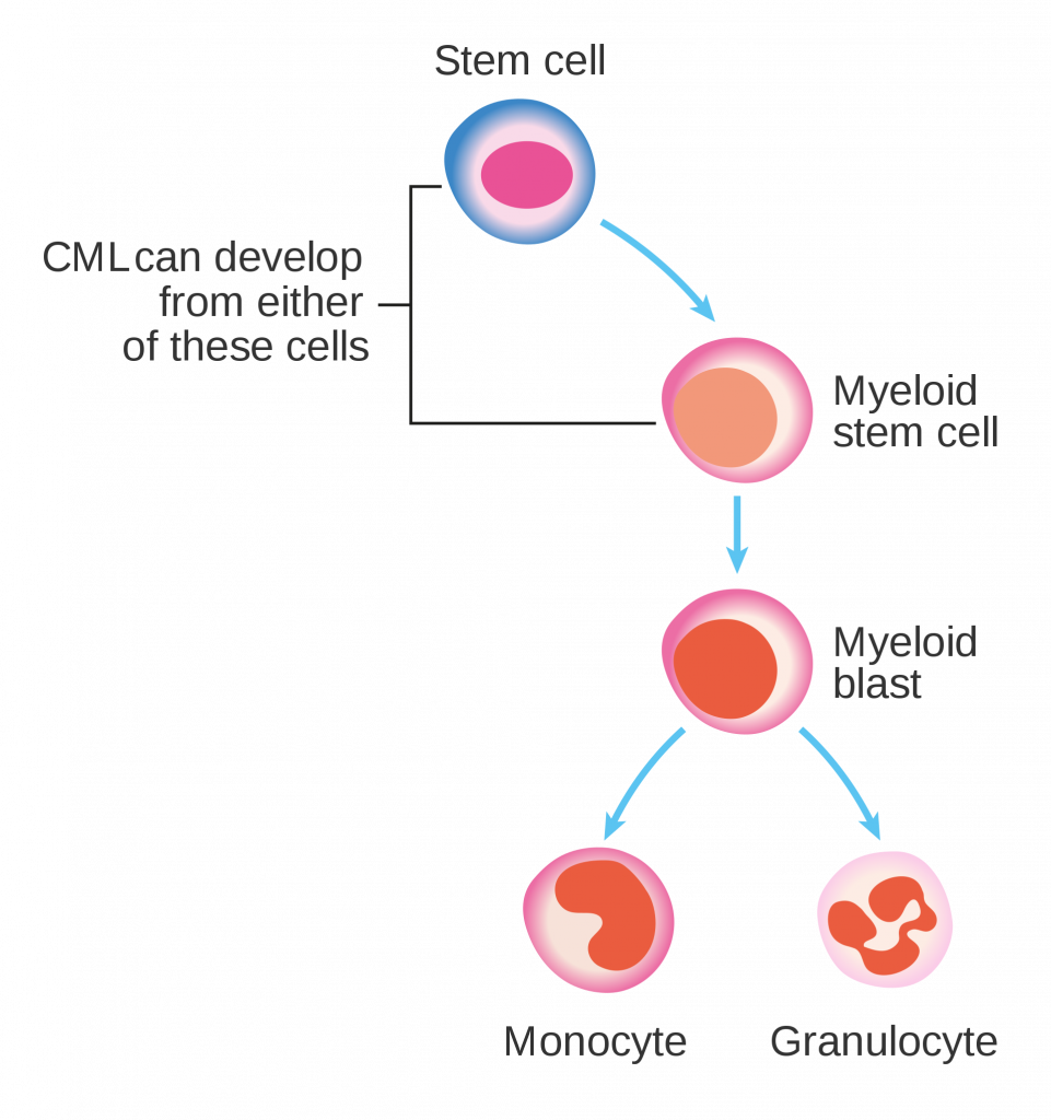A diagram showing that either pluripotent or myeloid stem cells may be the cells in which CML begins.